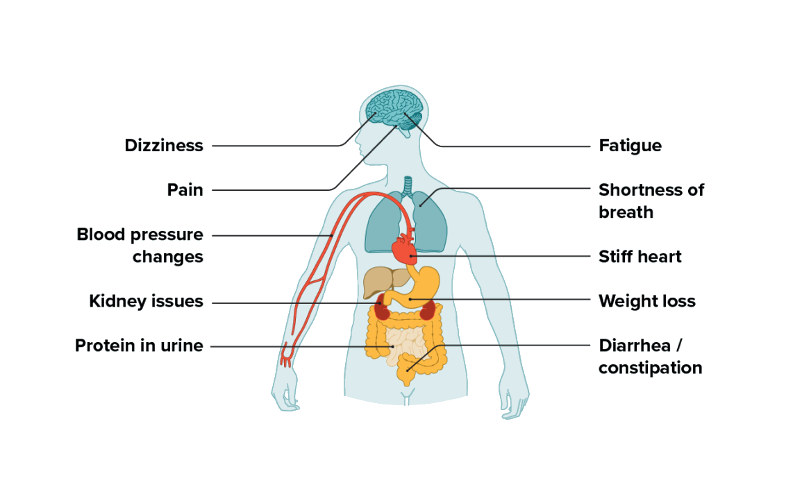 Amyloidosis: Signs & Symptoms